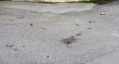 Okul önünde bacağından vuruldu