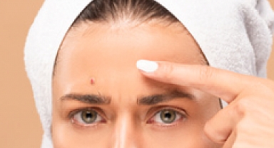 Günümüz Cilt Sorunları: Nedenleri ve Önlenme Yolları