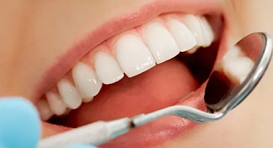 Diş Çürüklerini Önlemenin Yolları: Sağlıklı Ağız İçin İpuçları