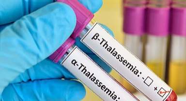 Akdeniz Anemisi Neden ve Belirtileri