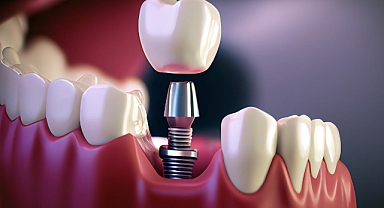 EKSİK DİŞ SAĞLIK İÇİN BÜYÜK TEHLİKE