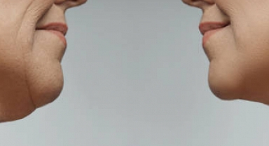 Gıdı Sarkması Nedir? Neden olur?