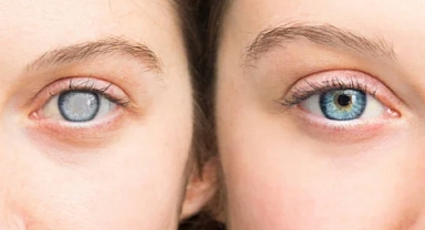 Kadınlarda Görülen En Sık Göz Problemleri