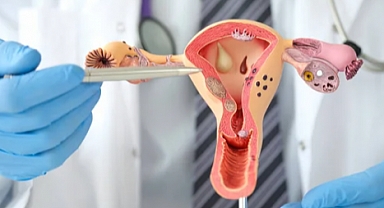 Rahim Kanseri: Belirtiler ve Erken Teşhisin Önemi