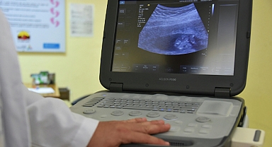 Kırklareli Hastanesi Yeni Ultrason Hizmeti: Mesai Dışı Randevular Başladı