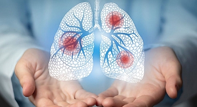 Kırklareli Eğitim ve Araştırma Hastanesinden Akciğer Kanseri Farkındalık Çağrısı