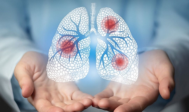 Kırklareli Eğitim ve Araştırma Hastanesinden Akciğer Kanseri Farkındalık Çağrısı